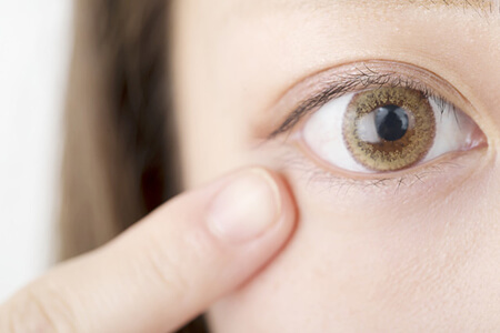 近視手術(shù)后流眼淚怎么辦?