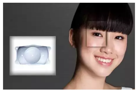 近視眼做了ICL手術(shù)要每年復(fù)查嗎？