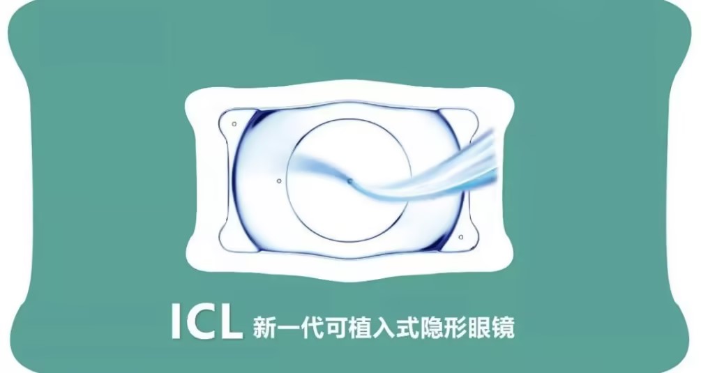 合肥ICL晶體植入近視手術(shù)，您了解多少？